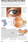 Devious Disease Robs You Blind